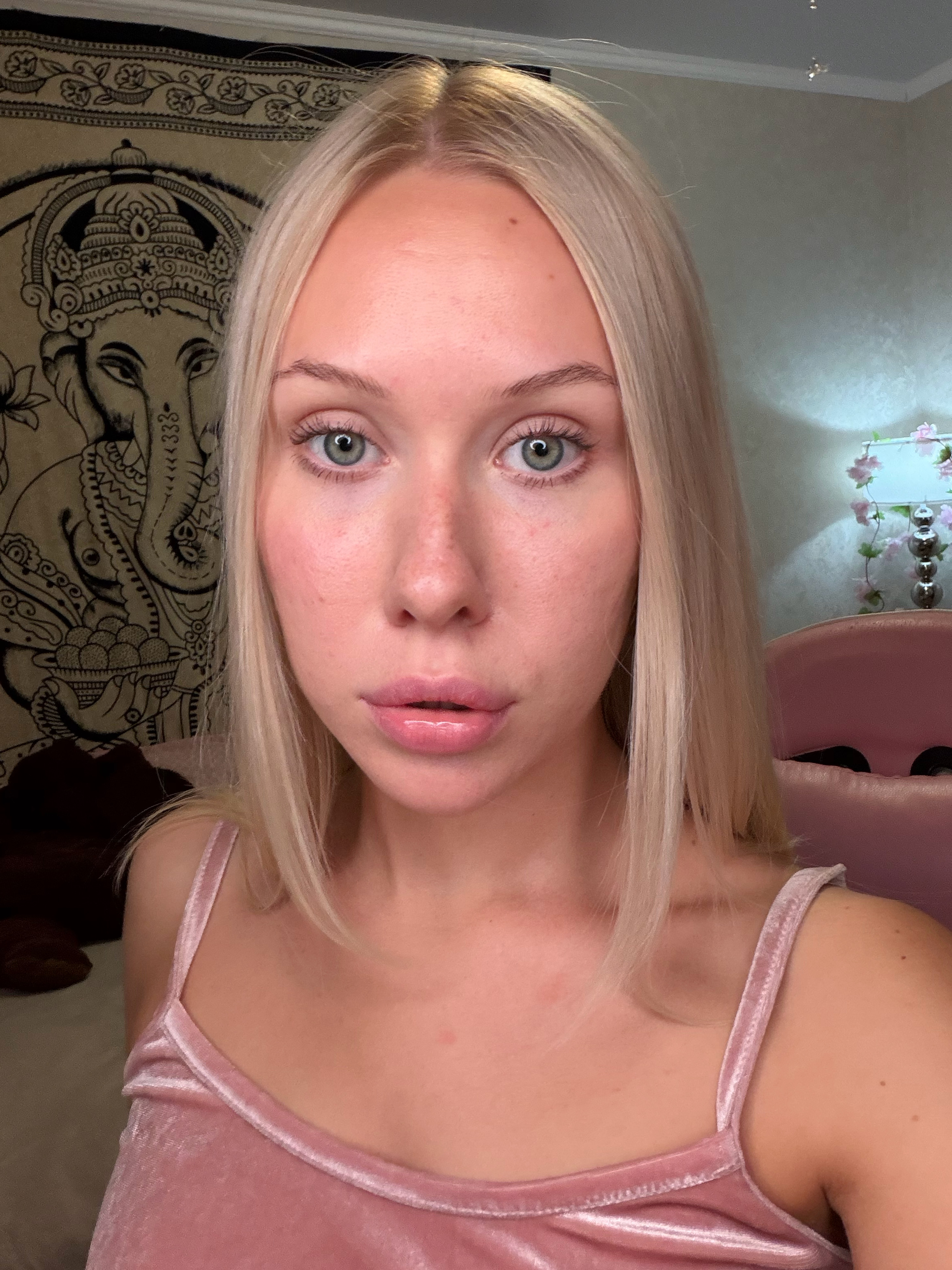 Маргарита до применения MERFISS