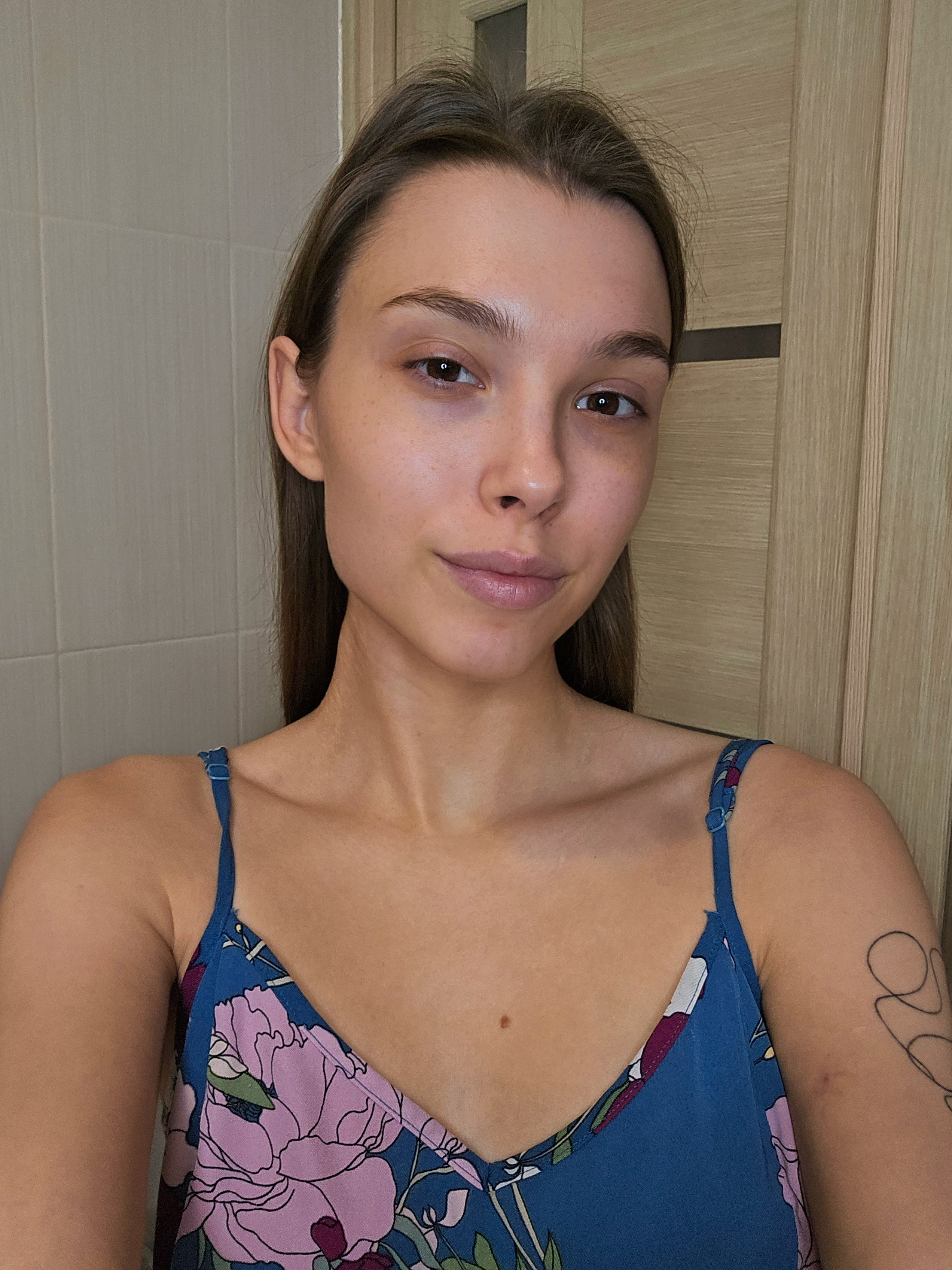Марина после 5 дней применения MERFISS